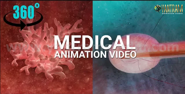 Medical-Animation-virtual-reality-studio-interactive-video.png -  by Yantramarchitecturaldesignstudio